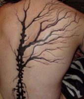 drzewo kręgosłup nerwy